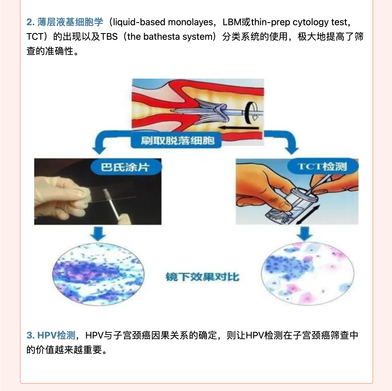 規(guī)范化篩查，遠離宮頸腫瘤