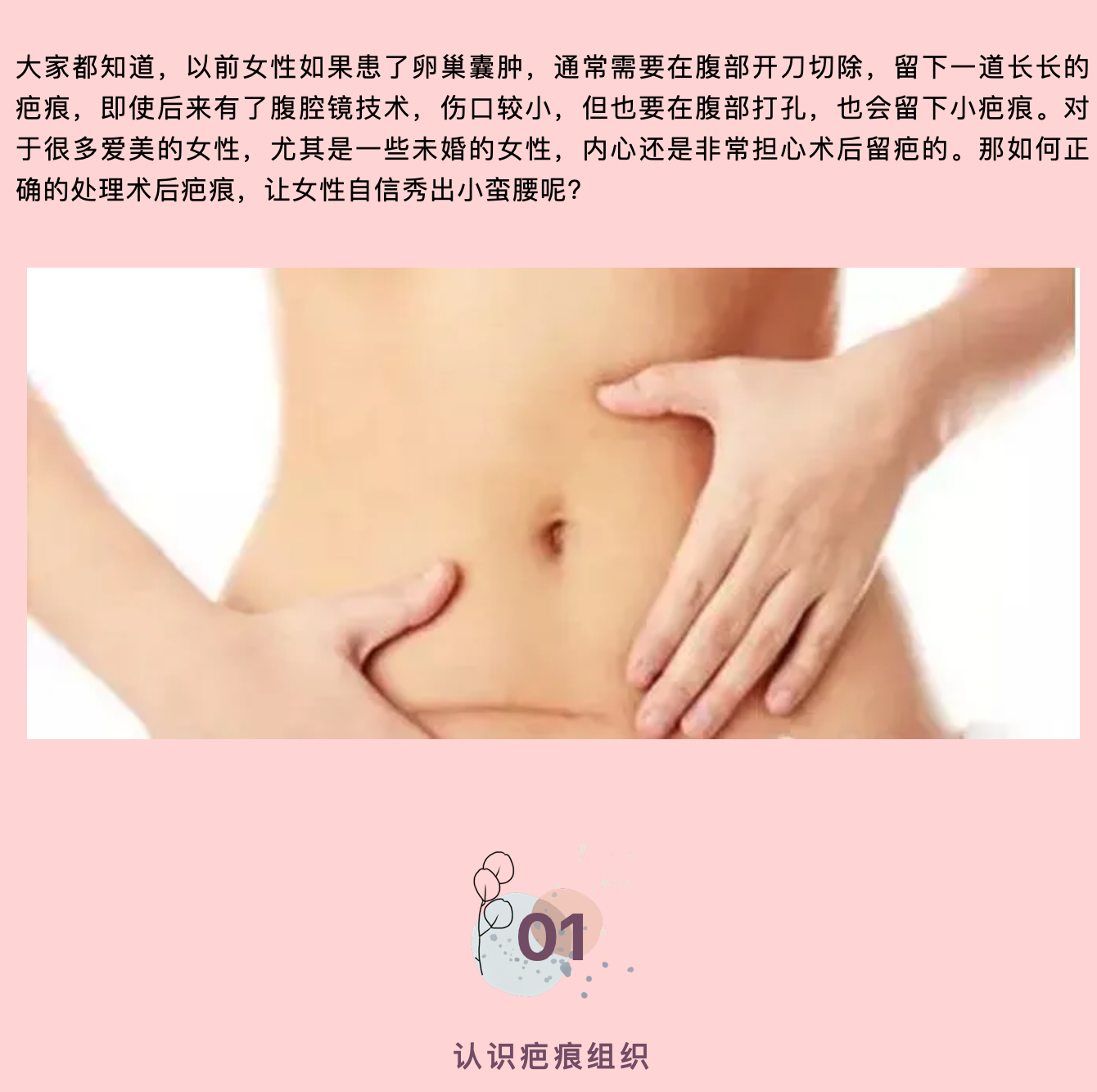 女性婦科術(shù)后這樣做，不再為“疤”而煩惱