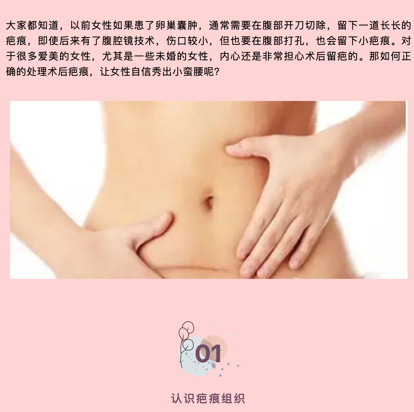 女性妇科术后这样做，不再为“疤”而烦恼