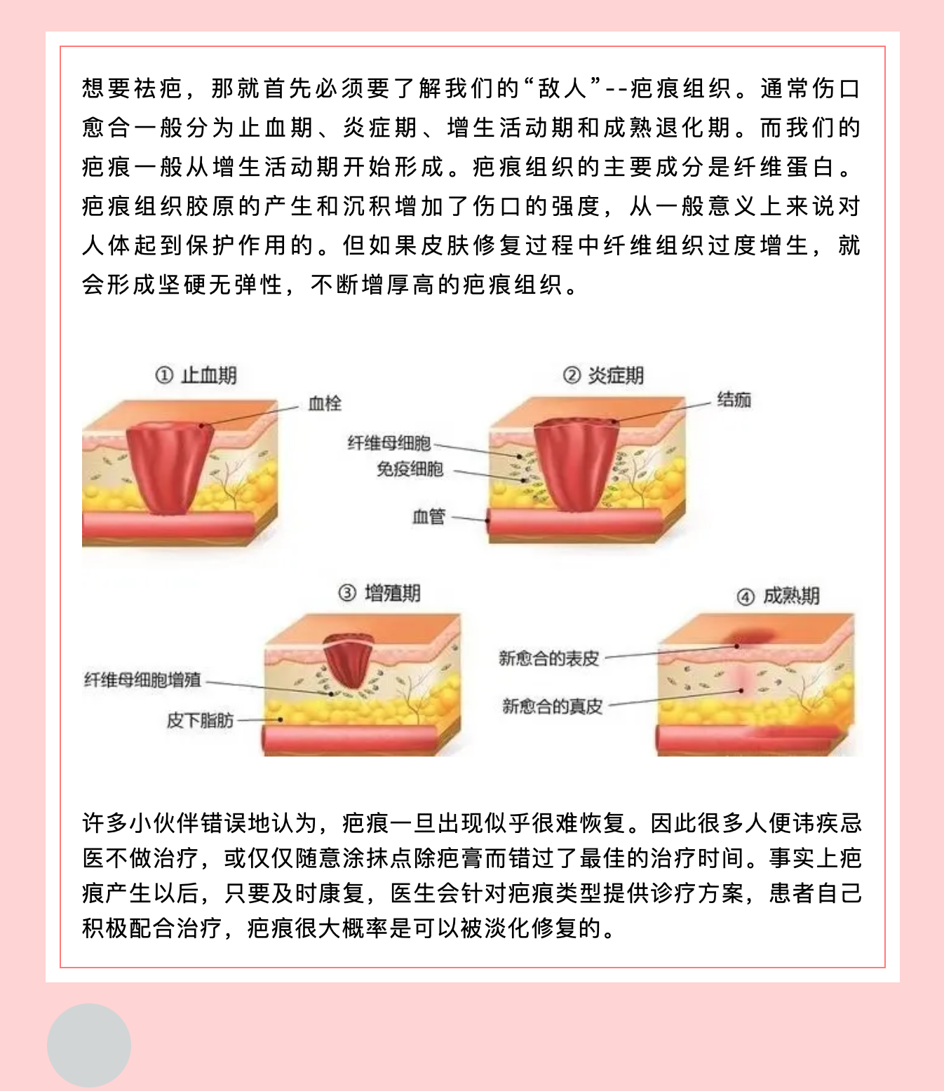 女性婦科術(shù)后這樣做，不再為“疤”而煩惱