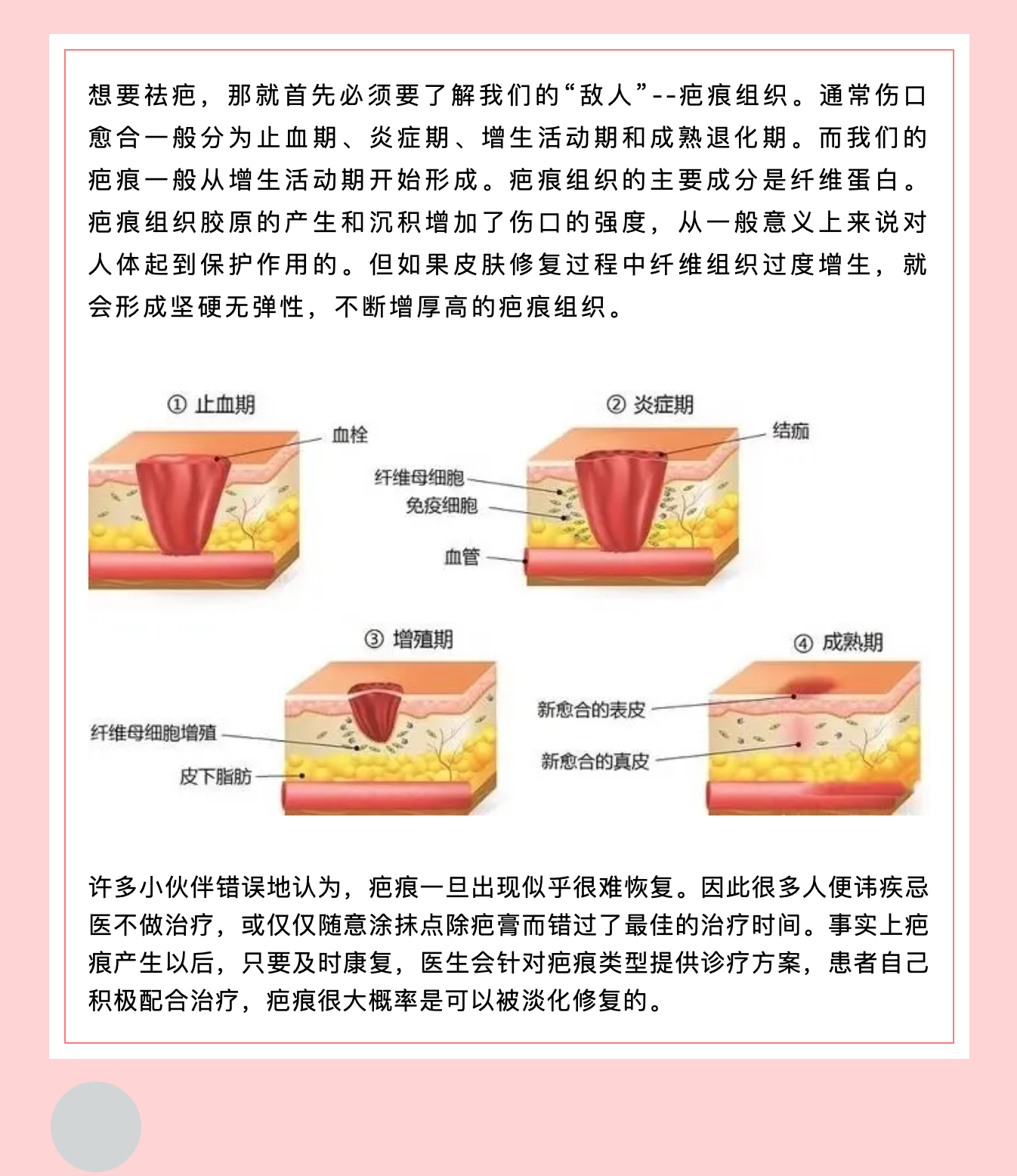 女性妇科术后这样做，不再为“疤”而烦恼