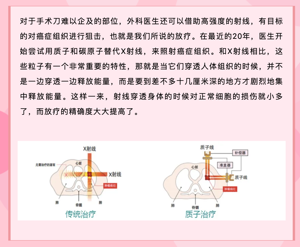 我们离战胜乳腺癌还有多远