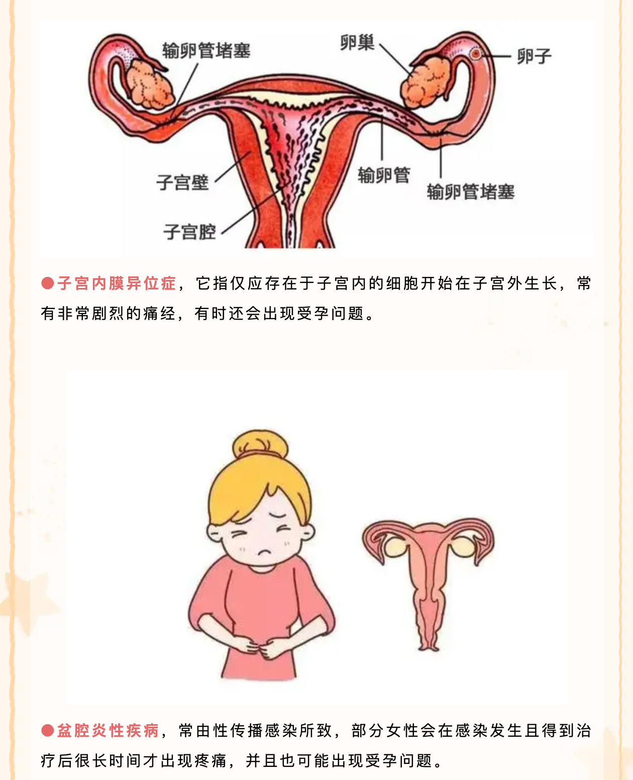 盆骨疼痛是怎么回事图片