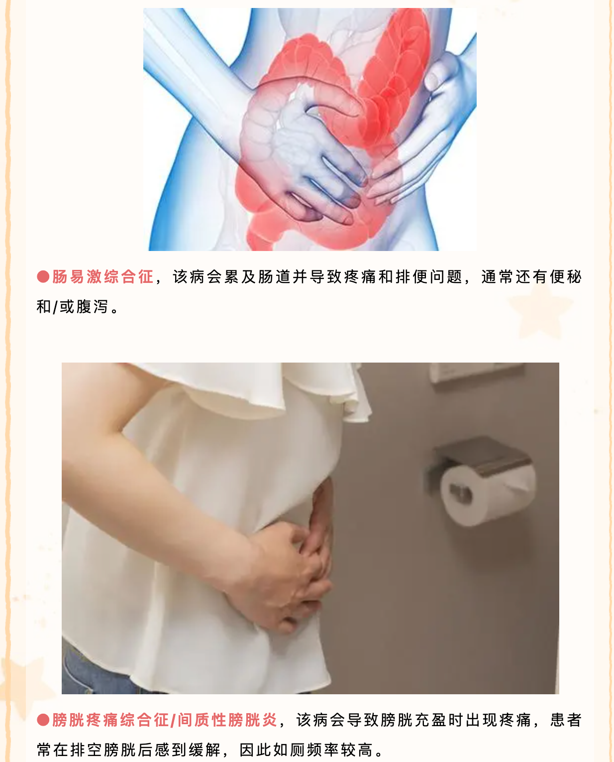 女性慢性盆腔痛原因