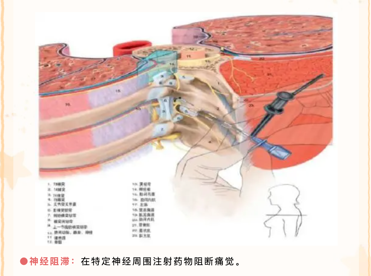 女性慢性盆腔痛原因