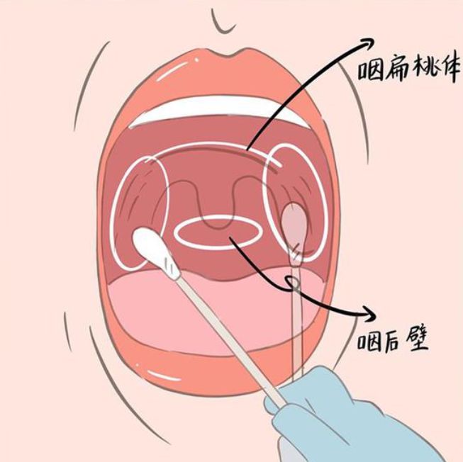 核酸检测嘴巴示意图图片