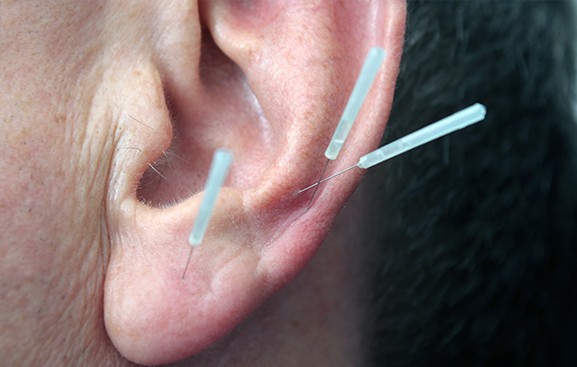 按耳朵真的能治百病吗？