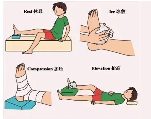 “医”说就懂 | 崴脚，只有0次或者无数次？-第3张图片-大猪科技网