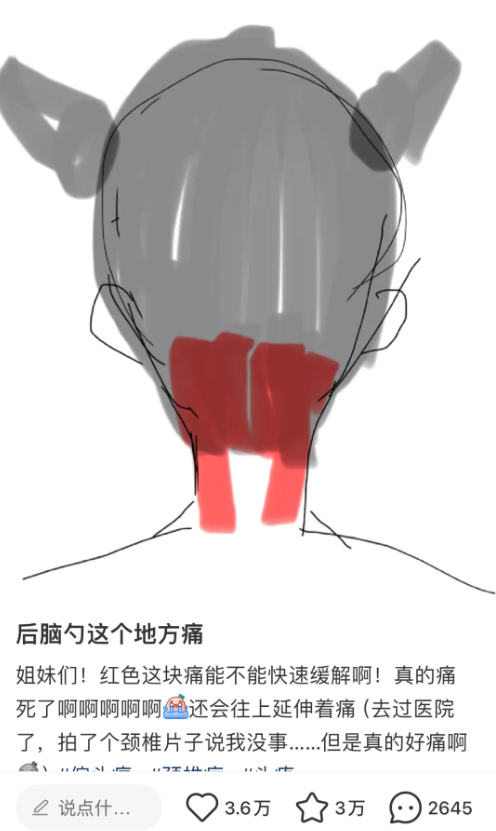 画手“求助贴”引热议：后脑勺这里疼，不是偏头痛-第1张图片-大猪科技网