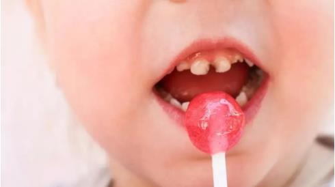 “吃糖蛀牙”的观念该换了！龋齿“真凶”不止有它 · 