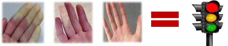 &ldquo;医&rdquo;说就懂丨&ldquo;求救信号灯&rdquo;:认识雷诺综合征