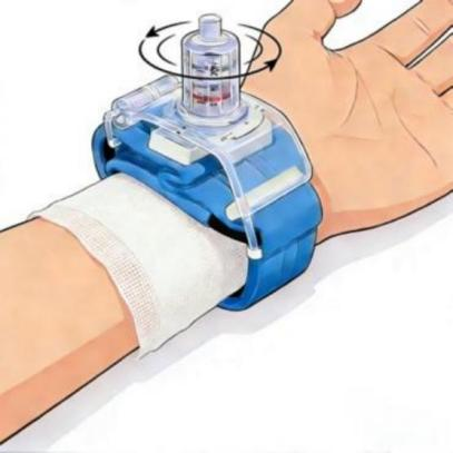 为什么一次性压脉带“医”说就懂丨止血小帮手——这个“压迫感”很有安全感_https://www.jmylbn.com_新闻资讯_第2张