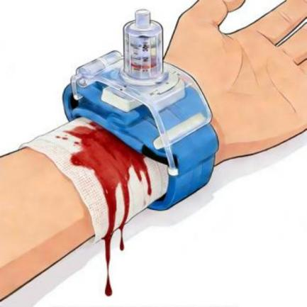 为什么一次性压脉带“医”说就懂丨止血小帮手——这个“压迫感”很有安全感_https://www.jmylbn.com_新闻资讯_第3张