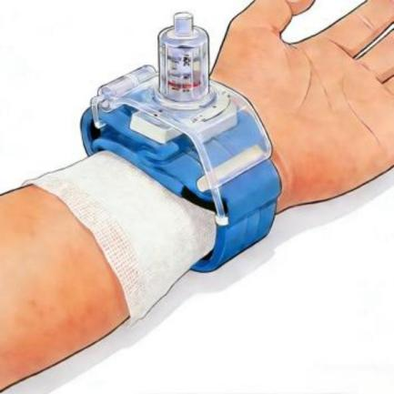 为什么一次性压脉带“医”说就懂丨止血小帮手——这个“压迫感”很有安全感_https://www.jmylbn.com_新闻资讯_第4张