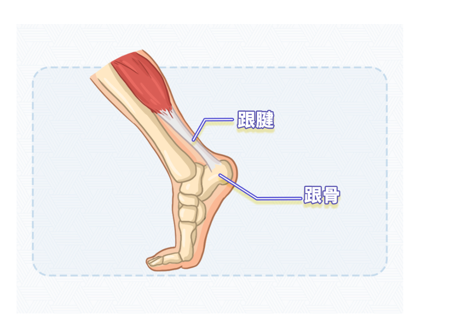 运动达人们要保护好你的跟腱，预防跟腱炎的发生！