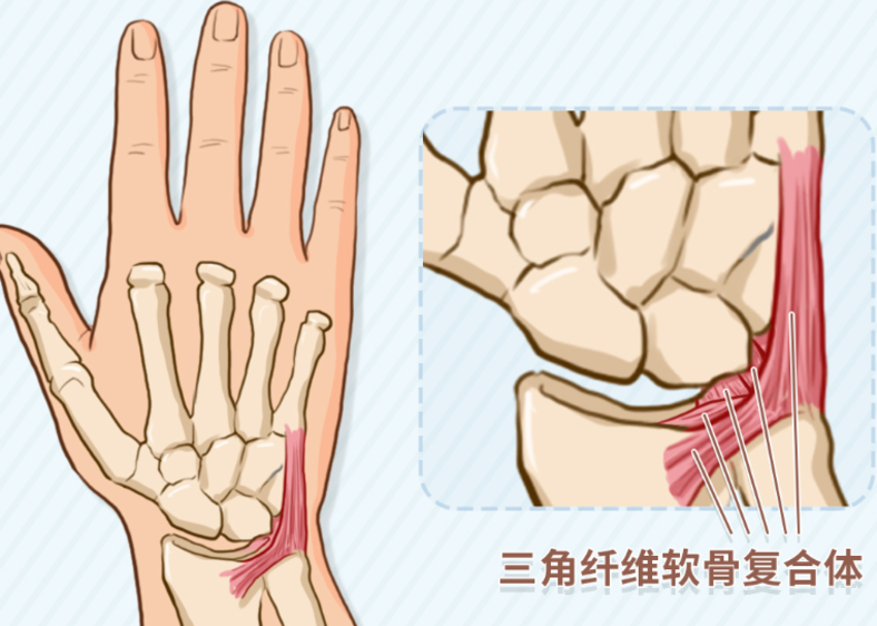 手腕疼，无法拧毛巾，起床时无法撑床，是哪里出问题了？