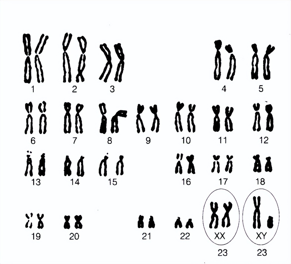 Y染色体与Y染色体显微缺失症