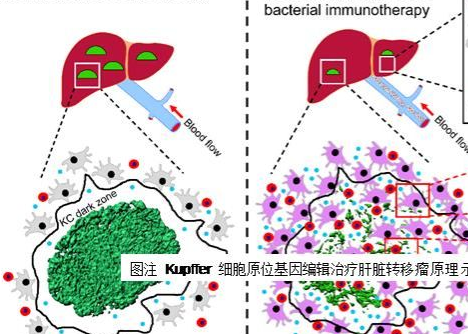 中国科技大学揭示肝转移癌免疫逃逸新机制及靶向治疗策略