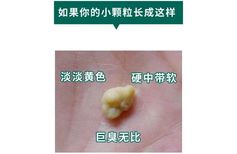 天天刷牙还口臭？这颗 “黄色臭粒” 藏着关键答案