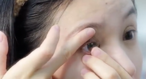戴隐形眼镜险失明？这些“坑”90%的人都踩过