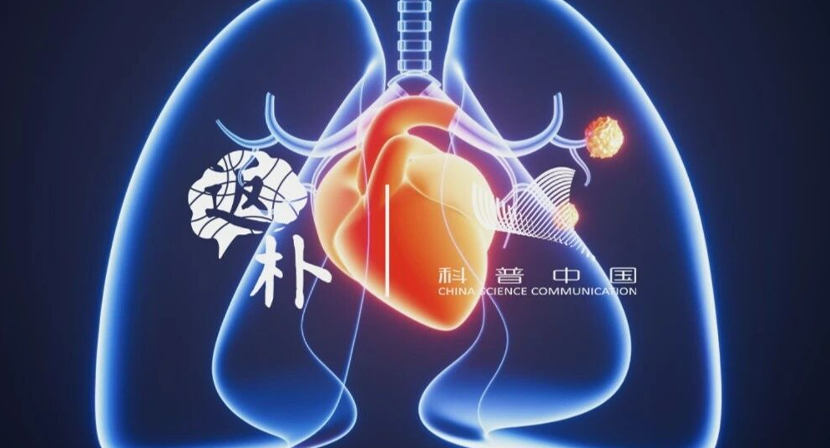 癌症与心脏病，为何经常“死磕”同一人？