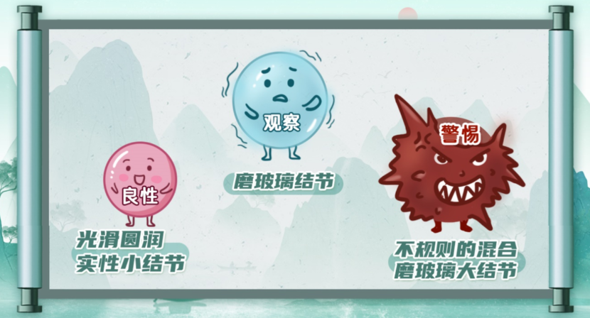 体检单上出现“肺结节”就是得了癌？ 专家说：90%都是虚惊一场
