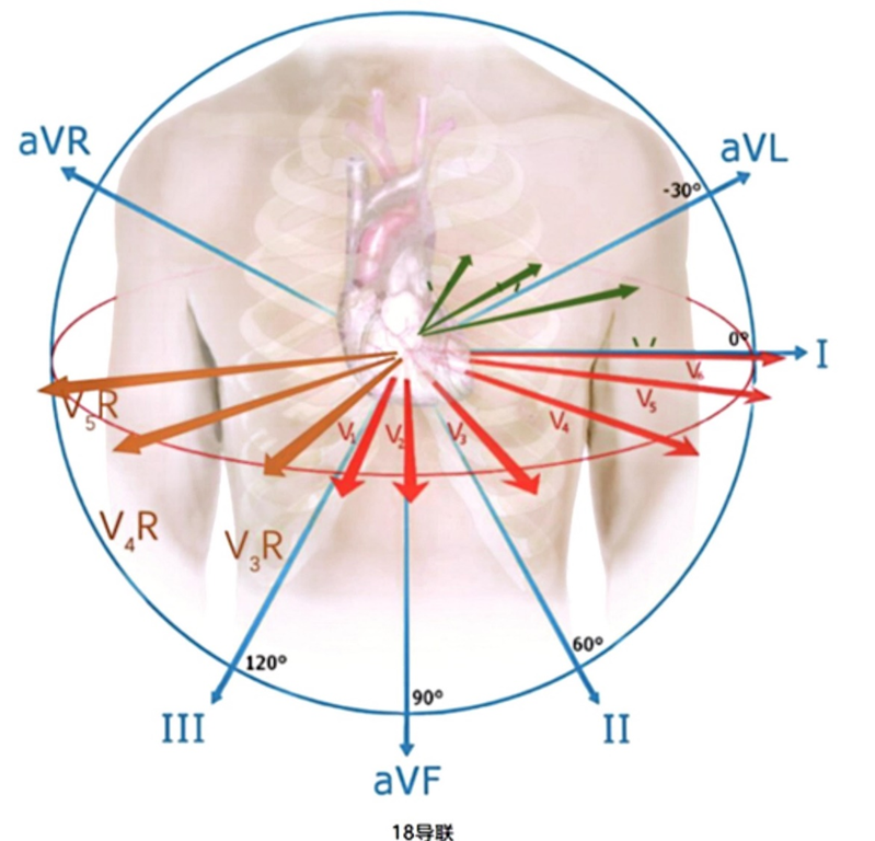 心电监护f n是什么一文读懂18导联心电图，比12导联更全面_https://www.jmylbn.com_新闻资讯_第1张