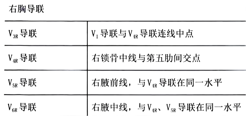 心电监护f n是什么一文读懂18导联心电图，比12导联更全面_https://www.jmylbn.com_新闻资讯_第3张